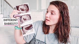 POSSIBLE TWINS FIRST ULTRASOUND  PREGNANCY UPDATE AT 8 WEEKS [upl. by Ecirtaeb]