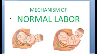 Labor  Occipito Posterior [upl. by Anis]