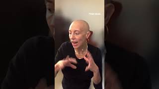 Woman living with alopecia reacts to 4B movement [upl. by Nama]