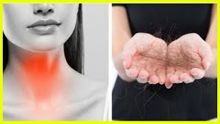 6 Étapes Faciles Pour Guérir Votre Thyroïde Naturellement [upl. by Aehsa]