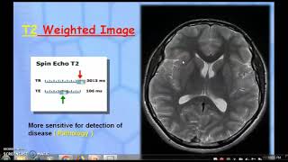 PART1 MAGNETIC RESONANCE IMAGING RECORDED WEBINAR [upl. by Savage]