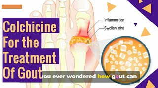 COLCHICINE Tablets For The GOUT Treatment [upl. by Kurtis319]