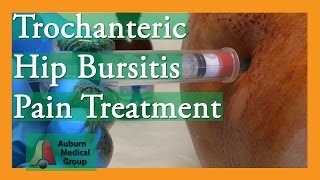 Trochanteric Hip Bursitis Pain Treatment  Auburn Medical Group [upl. by Amik]