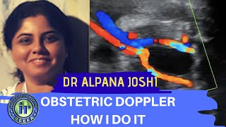 Obstetric Doppler  How I Do It  Dr Alpana Joshi  UMBILICAL ARTERY DOPPLER  MCA PI [upl. by Paderna660]