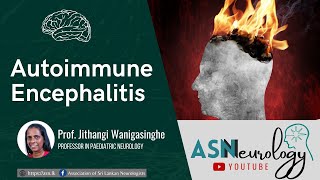 Autoimmune Encephalitis by Prof Jithangi Wanigasignhe [upl. by Llirpa]