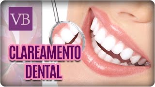 Mitos e Verdades do Clareamento Dental  Você Bonita 250117 [upl. by Attiuqal908]