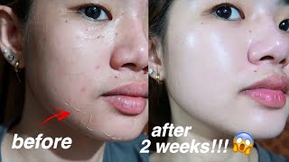 KOREAN SKIN IS REAL😱 I TRIED REJUVINATING SET FOR 2 WEEKS AND THIS IS WHAT HAPPENED [upl. by Orual402]