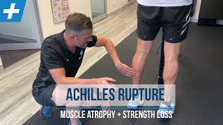 Achilles Rupture Rehab  Calf Muscle Atrophy and Strength Loss  Tim Keeley  Physio REHAB [upl. by Scherle]