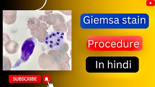 Giemsa stain procedure in hindi l giemsa stain kese karte hai l Giemsa stain for bone merrow l [upl. by Lubbock464]