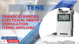 Transcutaneous Electrical Nerve Stimulation TENS applying Electrode Placement [upl. by Okun]