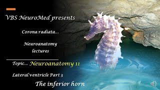 Neuroanatomy 11 Lateral ventricle Part 3 The inferior horn [upl. by Rima]