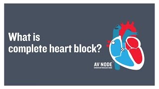 What is complete heart block [upl. by Yenots]