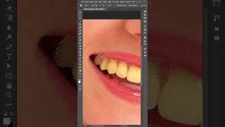 Teeth whitening  Shine your teeth like a pearl in Photoshop design [upl. by Jenne821]