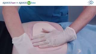 AQUACEL® Foam Application  Sacral Pressure Ulcer [upl. by Netsrejk338]