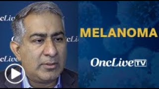 Dr Khushalani on FixedDose Treatment Regimens in Advanced Melanoma [upl. by Saloma]