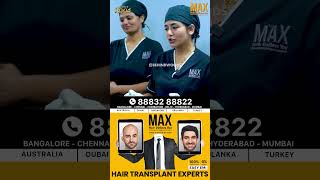 Want flawless hair like Ma ka pa Anand ➡Visit Max Hair Clinic hairclinic hairfallcontrol [upl. by Assed497]