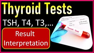 Thyroid Test  TSH T4 T3 Tests Explained  Thyroid Test Report Interpretation [upl. by Nosrettap]