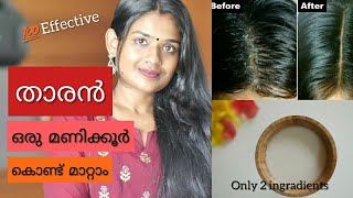 How to Get Rid of Dandruff  Miracle Cure For Dandruff  Homemade Natural Treatment [upl. by Bakki773]