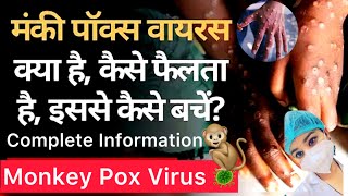 Monkey Pox Virus Cause Symptoms Diagnose And Treatment  Monkey pox Virus  Monkey Pox  M Pox [upl. by Jerroll]