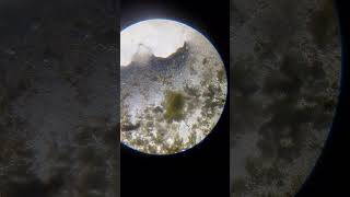 Bacteria paramecium and ciliates [upl. by Harley605]