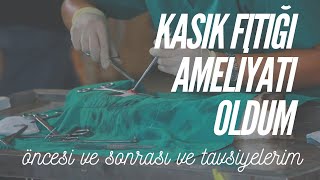 Kasık Fıtığı Ameliyatı Oldum Tavsiyeler [upl. by Sidran]