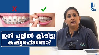 ഇനി പല്ലിൽ ക്ലിപ്പ് ഇട്ട് കഷ്ടപ്പെടേണ്ട   Dr Anisha  Health Tips  L Bug Media [upl. by Schulein881]