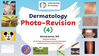 Dermatology Photo Revision 4 [upl. by Bucher602]