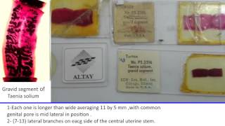 37 Practical Parasitology Grossly T Solium  T Saginata [upl. by Avi]