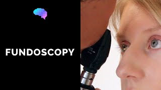 Fundoscopy Ophthalmoscopy  OSCE Guide  UKMLA  CPSA [upl. by Madigan]