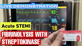 Fibrinolysis with streptokinase in acute STEMI  fibrinolisis pada STEMI serangan jantung berat [upl. by Holle]