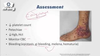 Thrombocytopenia NCLEX® Review  NRSNGacademycom [upl. by Enalda]