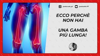 BACINO DISALLINEATO ECCO PERCHÈ NON HAI UNA GAMBA PIÙ LUNGA [upl. by Ashelman171]