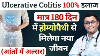 2 BEST Homeopathic medicine for Ulcerative Colitis you MUST take [upl. by Sokram]