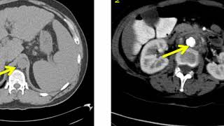 Introduction to Radiology Computed Tomography [upl. by Eirrehs230]