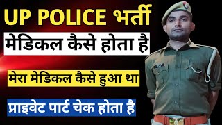 पुलिस का मेडिकल कैसे होता है UP Police ka medical kaise hota hai UP Police medical [upl. by Denni586]