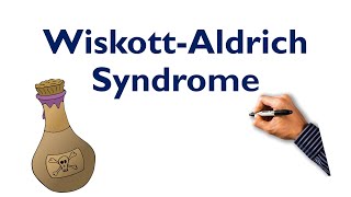 WiskottAldrich Syndrome Mnemonic STEP NCLEX COMLEX [upl. by Aldas807]