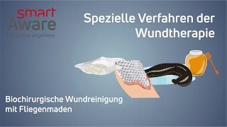 Wundreinigung  So wirken spezielle Methoden der Wundheilung von Medizinalhonig bis Fliegenlarven [upl. by Nagey]