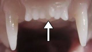 Worlds First Tooth Regrowing Drug Set To Start Human Trials [upl. by Salvay702]