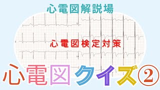 心電図解説場（心電図クイズ②） [upl. by Jefferey319]