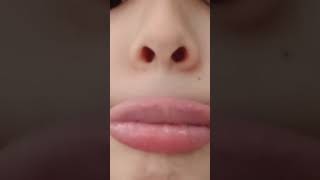 preenchimento labial para lábios [upl. by Joyan]