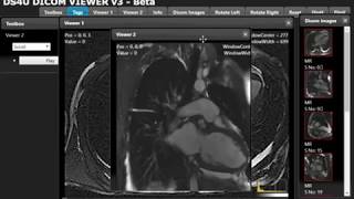 DreamSoft4u DICOM  PACS Imaging Solution [upl. by Elleniad]