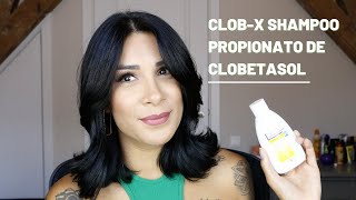 SHAMPOO PARA DERMATITE SEBORREICA CLOBX PROPIONATO DE CLOBETASOL  Por jessicatthings [upl. by Gareth965]