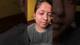 My chicken pox journey  golposongeshreya bengalivlog chickenpox pox [upl. by Ettevol]