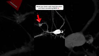 Brain cell restructures itself after forming a new connection neuroplasticity neuroscience brain [upl. by Aro909]