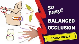 Balanced Occlusion Made Easy  PROSTHODONTICS [upl. by Ahtnams634]