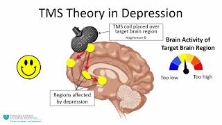 Transcranial Magnetic Stimulation A New Treatment Approach for Psychiatric Disorders [upl. by Airotnahs230]