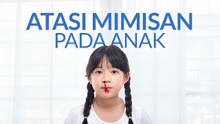 Ketahui Penyebab Mimisan pada Anak dan Cara Menanganinya [upl. by Flss]