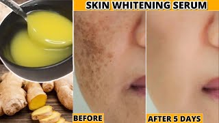 Best Skin👆🏼Whitening Serum Remove Pigmentations झाइयां Dark Spots SunTan Get Fair Bright Skin [upl. by Bobette]