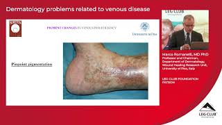 Professor Marco Romanelli Dermatology problems related to venous disease [upl. by Llerrut47]