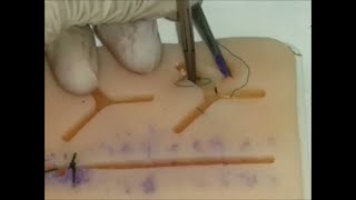 24 Three point junction suture [upl. by Surbeck525]